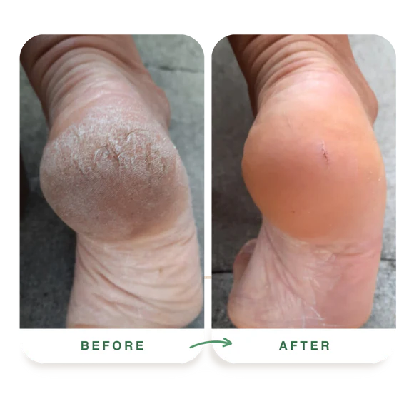 Feature product image